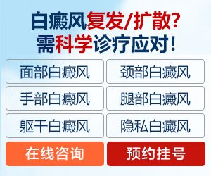 甘肃天水白斑医院?脚部出现白癜风该如何治疗呢？